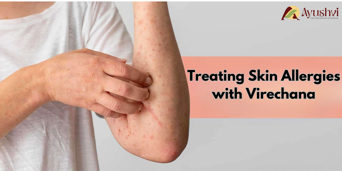 Treating Skin Allergies with Detox Virechana